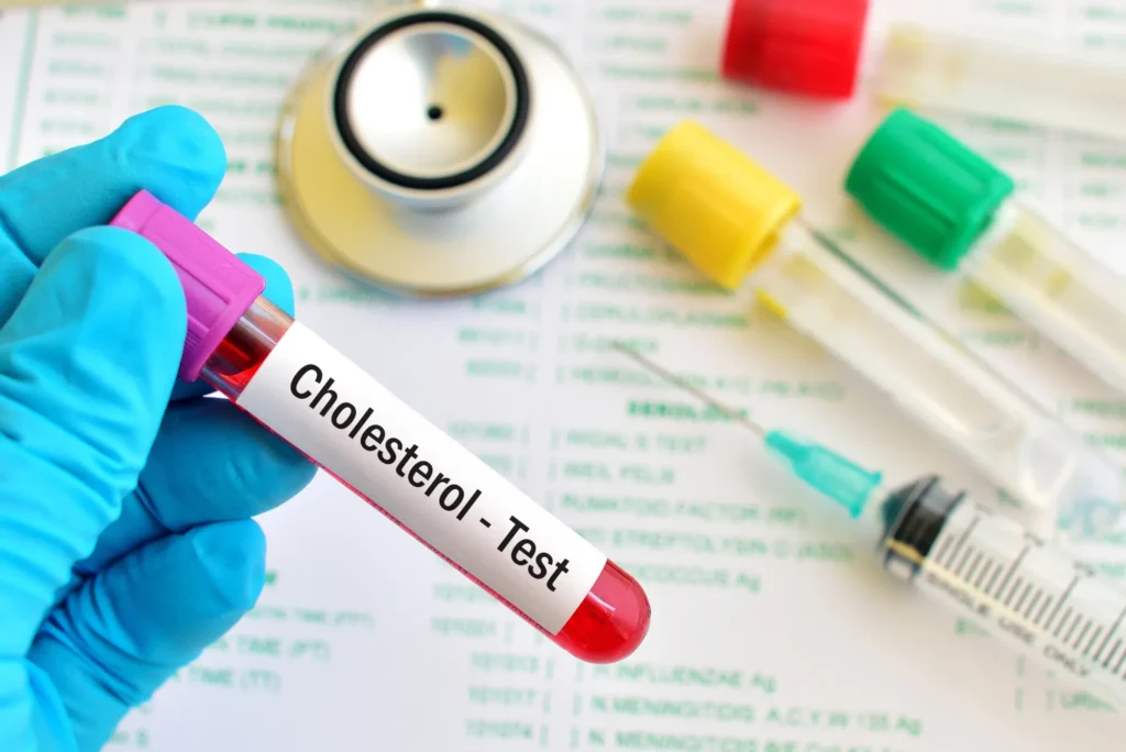 Cholesterol Test
